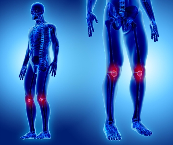 Osteoartrit (Kireçlenme)
